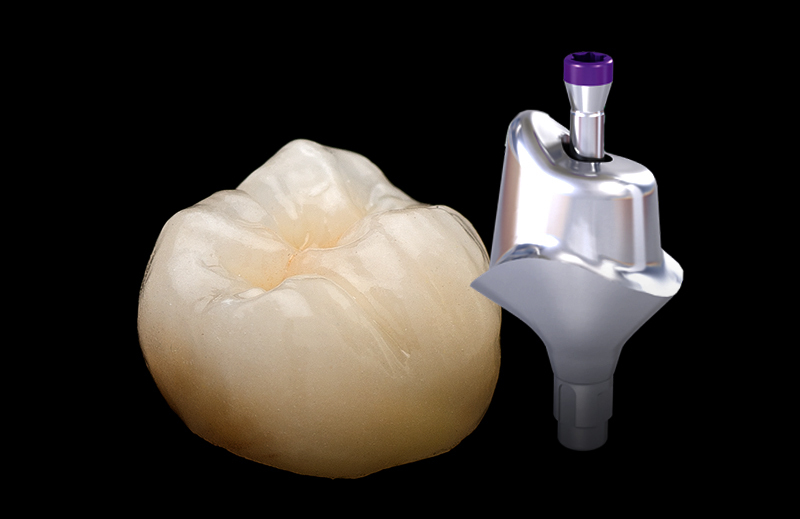 Implants
